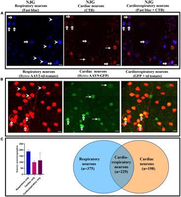 Convergent cardiorespiratory neurons represent a significant portion of cardiac and respiratory neurons in the vagal ganglia